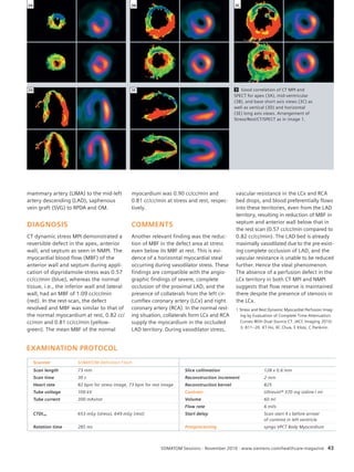 Topic 
3A 3B 3C 
vascular resistance in the LCx and RCA 
bed drops, and blood preferentially flows 
into these territories, even from the LAD 
territory, resulting in reduction of MBF in 
septum and anterior wall below that in 
the rest scan (0.57 cc/cc/min compared to 
0.82 cc/cc/min). The LAD bed is already 
maximally vasodilated due to the pre-exist-ing 
complete occlusion of LAD, and the 
vascular resistance is unable to be reduced 
further. Hence the steal phenomenon. 
The absence of a perfusion defect in the 
LCx territory in both CT MPI and NMPI 
suggests that flow reserve is maintained 
there despite the presence of stenosis in 
the LCx. 
SOMATOM Sessions · November 2010 · www.siemens.com/healthcare-magazine 43 
3D 3E 
mammary artery (LIMA) to the mid-left 
artery descending (LAD), saphenous 
vein graft (SVG) to RPDA and OM. 
DIAGNOSIS 
CT dynamic stress MPI demonstrated a 
reversible defect in the apex, anterior 
wall, and septum as seen in NMPI. The 
myocardial blood flow (MBF) of the 
anterior wall and septum during appli-cation 
of dipyridamole-stress was 0.57 
cc/cc/min (blue), whereas the normal 
tissue, i.e., the inferior wall and lateral 
wall, had an MBF of 1.09 cc/cc/min 
(red). In the rest-scan, the defect 
resolved and MBF was similar to that of 
the normal myocardium at rest, 0.82 cc/ 
cc/min and 0.81 cc/cc/min (yellow-green). 
The mean MBF of the normal 
myocardium was 0.90 cc/cc/min and 
0.81 cc/cc/min at stress and rest, respec-tively. 
COMMENTS 
Another relevant finding was the reduc-tion 
of MBF in the defect area at stress 
even below its MBF at rest. This is evi-dence 
of a horizontal myocardial steal 
occurring during vasodilator stress. These 
findings are compatible with the angio-graphic 
findings of severe, complete 
occlusion of the proximal LAD, and the 
presence of collaterals from the left cir-cumflex 
coronary artery (LCx) and right 
coronary artery (RCA). In the normal rest-ing 
situation, collaterals form LCx and RCA 
supply the myocardium in the occluded 
LAD territory. During vasodilator stress, 
3 Good correlation of CT MPI and 
SPECT for apex (3A), mid-ventricular 
(3B), and base short axis views (3C) as 
well as vertical (3D) and horizontal 
(3E) long axis views. Arrangement of 
Stress/Rest/CT/SPECT as in image 1. 
1 Stress and Rest Dynamic Myocardial Perfusion Imag-ing 
by Evaluation of Complete Time-Attenuation 
Curves With Dual-Source CT. JACC Imaging 2010; 
3: 811–20. KT Ho, KC Chua, E Klotz, C Panknin. 
EXAMINATION PROTOCOL 
Scanner SOMATOM Definition Flash 
Scan length 73 mm Slice collimation 128 x 0.6 mm 
Scan time 30 s Reconstruction increment 2 mm 
Heart rate 82 bpm for stress image, 73 bpm for rest image Reconstruction kernel B25 
Tube voltage 100 kV Contrast Ultravist® 370 mg iodine / ml 
Tube current 300 mAs/rot Volume 60 ml 
Flow rate 6 ml/s 
CTDIvol 653 mGy (stress), 649 mGy (rest) Start delay Scan start 4 s before arrival 
of contrast in left ventricle 
Rotation time 285 ms Postprocessing syngo VPCT Body Myocardium 
 