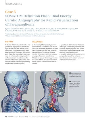 Clinical Results Oncology 
Case 5 
SOMATOM Defi nition Flash: Dual Energy 
Carotid Angiography for Rapid Visualization 
of Paraganglioma 
By João Carlos Costa, MD;* J. Oliveira, MD;* J. Dinis, MD;* R. Duarte, MD;* O. Borlido, RT;* M. Gonçalves, RT;* 
D. Martins, RT;* S. Silva, RT;* D. Teixeira, RT,* A. Chaves,** and Andreas Blaha** 
* Radiology Department, Hospital Particular de Viana do Castelo, Viana do Castelo, Portugal 
** Business Unit CT, Siemens Healthcare, Forchheim, Germany 
HISTORY 
A 30-year-old female patient with a one-year 
history of progressive growth of a 
right cervical mass was referred to the CT 
department. There were no associated 
local symptoms. The patient did not com-plain 
of pain but reported physical weak-ness. 
An echo-doppler study revealed a 
well-defined solid mass between the 
internal and external right carotid arter-ies 
with intense arterial irrigation being 
suggestive of a paraganglioma. 
DIAGNOSIS 
A Dual Energy CT angiography examina-tion 
confirmed a solid mass with the size 
of 2.5 cm in diameter, located in the right 
carotid bulb which could lead to carotid 
paraganglioma. The arterial enhance-ment 
of the carotid arteries did not show 
any signs of stenoses or occlusions. 
There is no vascular abnormity present in 
the Circle of Willis. Due to exact contrast 
timing, venous contamination could be 
avoided. 
46 SOMATOM Sessions · November 2010 · www.siemens.com/healthcare-magazine 
A typical sharp delineation of the lesion 
in the right carotid artery confirmed the 
suspicion of paraganglioma. The patient 
was referred to surgery where the initial 
diagnosis could be confirmed. 
A complete isolation and resection of the 
paraganglioma could be achieved. 
Convalescence of the patient was short 
and no complications arose. 
1 Dual Energy VRT of 
the right carotid artery 
shows a cervical mass. 
2 Dual Energy VRT 
view of right carotid 
artery, focusing on 
carotid bifurcation 
(arrow). 
1 2 
 