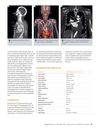 4 5 6 
SOMATOM Sessions · November 2010 · www.siemens.com/healthcare-magazine 61 
coronary arteries had stenoses (Fig. 2) 
and no significant abnormity of the aorta 
or cerebrovascular region (Fig. 3 and 4) 
was found. With these results, acute cor-onary 
syndrome, aortic dissection and 
stroke could be ruled out. The pericar-dial 
effusion was diagnosed as chronic 
on echocardiography. Based on the 
left ventricle myocardial hypertrophy 
finding, we suspected hypertrophic 
obstructive cardiomyopathy. 
A diuretic worked well to improve car-diac 
function and respiratory condition. 
After performing tracheotomy, the 
patient’s respiratory status gradually 
improved and she could be weaned from 
ventilatory support after 43 days in 
the hospital. Her level of consciousness 
(LOC) came back to E4VTM6 (GCS) 
and oxygenation could be stopped. On 
the 48th day, the patient was transferred 
to another hospital to receive rehabilita-tion. 
COMMENTS 
Dual Source CT Flash Spiral was used 
for long range CT-Angiography (Fig. 5). 
It gave us necessary information to rule 
out critical acute coronary syndrome, 
thoracic aortic dissection and cerebrovas-cular 
lesions. The Flash Spiral mode is 
5 Dual Source CT Flash Spiral was used 
for long range CT angiography. 
6 The fast pitch of 2.3 allows acquiring motion 
free images in patients who cannot hold their 
breath. 
4 No significant abnormity of the 
aorta. 
an extremely useful tool, in particular 
for ruling out life-threatening disorders 
at initial treatment phase without hav-ing 
to subject the patient to additional 
invasive examinations such as cardiac 
catheterization. As the Flash Spiral scan 
mode has a fast pitch of 2.3 (up to pitch 
3.4), diagnostic images can be acquired 
even of patients who cannot hold their 
breath which is especially useful at 
Trauma and Acute Critical Care Centers 
(Fig. 6). 
EXAMINATION PROTOCOL 
Scanner SOMATOM Definition Flash 
Scan mode Flash Thorax 
Scan area Head to Thorax 
Scan length 570.5 mm 
Scan direction Caudo-cranial 
Scan time 2.07 s 
Tube voltage 120 kV / 120kV 
Tube current 162 eff. mAs 
Dose modulation CARE Dose4D 
CTDIvol 9.06 mGy 
DLP 574 mGy cm 
Rotation time 0.28 s 
Pitch 2.3 
Slice collimation 0.6 mm 
Slice width 0.75 mm 
Reconstruction increment 0.6 mm 
Reconstruction kernel B35f 
Contrast 
Volume 95 ml 
Flow rate 4.0 ml/s 
Start delay 28 s Bolus Tracking 
 