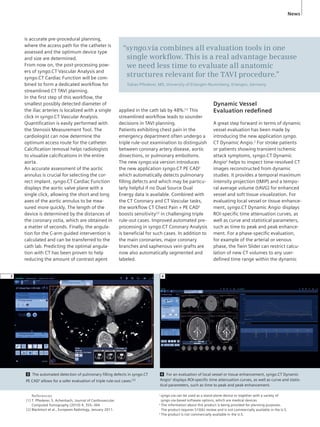 News 
“syngo.via combines all evaluation tools in one 
single workfl ow. This is a real advantage because 
we need less time to evaluate all anatomic 
structures relevant for the TAVI procedure.” 
Tobias Pfl ederer, MD, University of Erlangen-Nuremberg, Erlangen, Germany 
3 The automated detection of pulmonary filling defects in syngo.CT 
PE CAD3 allows for a safer evaluation of triple rule-out cases.[2] 
References 
[1] T. Pflederer, S. Achenbach, Journal of Cardiovascular 
Computed Tomography (2010) 4, 355–364 
[2] Blackmon et al., European Radiology, January 2011. 
4 For an evaluation of local vessel or tissue enhancement, syngo.CT Dynamic 
Angio2 displays ROI-specific time attenuation curves, as well as curve and statis-tical 
parameters, such as time to peak and peak enhancement. 
is accurate pre-procedural planning, 
where the access path for the catheter is 
assessed and the optimum device type 
and size are determined. 
From now on, the post-processing pow-ers 
of syngo.CT Vascular Analysis and 
syngo.CT Cardiac Function will be com-bined 
to form a dedicated workfl ow for 
streamlined CT TAVI planning. 
In the fi rst step of this workfl ow, the 
smallest possibly detected diameter of 
the iliac arteries is localized with a single 
click in syngo.CT Vascular Analysis. 
Quantifi cation is easily performed with 
the Stenosis Measurement Tool. The 
cardiologist can now determine the 
optimum access route for the catheter. 
Calcifi cation removal helps radiologists 
to visualize calcifi cations in the entire 
aorta. 
An accurate assessment of the aortic 
annulus is crucial for selecting the cor-rect 
implant. syngo.CT Cardiac Function 
displays the aortic valve plane with a 
single click, allowing the short and long 
axes of the aortic annulus to be mea-sured 
more quickly. The length of the 
device is determined by the distances of 
the coronary ostia, which are obtained in 
a matter of seconds. Finally, the angula-tion 
for the C-arm guided intervention is 
calculated and can be transferred to the 
cath lab. Predicting the optimal angula-tion 
with CT has been proven to help 
reducing the amount of contrast agent 
4 
3 
applied in the cath lab by 48%.[1] This 
streamlined workfl ow leads to sounder 
decisions in TAVI planning. 
Patients exhibiting chest pain in the 
emergency department often undergo a 
triple rule-out examination to distinguish 
between coronary artery disease, aortic 
dissections, or pulmonary embolisms. 
The new syngo.via version introduces 
the new application syngo.CT PE CAD3 
which automatically detects pulmonary 
fi lling defects and which may be particu-larly 
helpful if no Dual Source Dual 
Energy data is available. Combined with 
the CT Coronary and CT Vascular tasks, 
the workfl ow CT Chest Pain + PE CAD3 
boosts sensitivity[2] in challenging triple 
rule-out cases. Improved automated pre-processing 
in syngo.CT Coronary Analysis 
is benefi cial for such cases. In addition to 
the main coronaries, major coronary 
branches and saphenous vein grafts are 
now also automatically segmented and 
labeled. 
Dynamic Vessel 
Evaluation redefi ned 
A great step forward in terms of dynamic 
vessel evaluation has been made by 
introducing the new application syngo. 
CT Dynamic Angio.2 For stroke patients 
or patients showing transient ischemic 
attack symptoms, syngo.CT Dynamic 
Angio2 helps to inspect time-resolved CT 
images reconstructed from dynamic 
studies. It provides a temporal maximum 
intensity projection (tMIP) and a tempo-ral 
average volume (tAVG) for enhanced 
vessel and soft tissue visualization. For 
evaluating local vessel or tissue enhance-ment, 
syngo.CT Dynamic Angio displays 
ROI-specifi c time attenuation curves, as 
well as curve and statistical parameters, 
such as time to peak and peak enhance-ment. 
For a phase-specifi c evaluation, 
for example of the arterial or venous 
phase, the Twin Slider can restrict calcu-lation 
of new CT volumes to any user-defi 
ned time range within the dynamic 
1 syngo.via can be used as a stand-alone device or together with a variety of 
syngo.via-based software options, which are medical devices 
2 The information about this product is being provided for planning purposes. 
The product requires 510(k) review and is not commercially available in the U.S. 
3 The product is not commercially available in the U.S. 
 