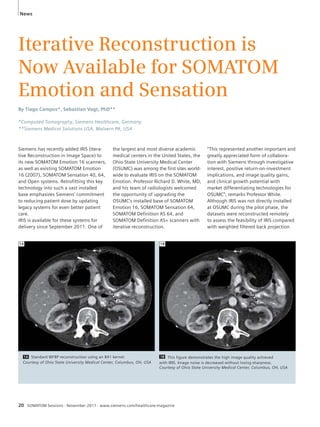 News 
Iterative Reconstruction is 
Now Available for SOMATOM 
Emotion and Sensation 
By Tiago Campos*, Sebastian Vogt, PhD** 
*Computed Tomography, Siemens Healthcare, Germany 
**Siemens Medical Solutions USA, Malvern PA, USA 
Siemens has recently added IRIS (Itera-tive 
Reconstruction in Image Space) to 
its new SOMATOM Emotion 16 scanners, 
as well as existing SOMATOM Emotion 
16 (2007), SOMATOM Sensation 40, 64, 
and Open systems. Retrofitting this key 
technology into such a vast installed 
base emphasizes Siemens’ commitment 
to reducing patient dose by updating 
legacy systems for even better patient 
care. 
IRIS is available for these systems for 
delivery since September 2011. One of 
the largest and most diverse academic 
medical centers in the United States, the 
Ohio State University Medical Center 
(OSUMC) was among the first sites world-wide 
to evaluate IRIS on the SOMATOM 
Emotion. Professor Richard D. White, MD, 
and his team of radiologists welcomed 
the opportunity of upgrading the 
OSUMC’s installed base of SOMATOM 
Emotion 16, SOMATOM Sensation 64, 
SOMATOM Definition AS 64, and 
SOMATOM Definition AS+ scanners with 
iterative reconstruction. 
1A 1B 
20 SOMATOM Sessions · November 2011 · www.siemens.com/healthcare-magazine 
“This represented another important and 
greatly appreciated form of collabora-tion 
with Siemens through investigative 
interest, positive return-on-investment 
implications, and image quality gains, 
and clinical growth potential with 
market differentiating technologies for 
OSUMC”, remarks Professor White. 
Although IRIS was not directly installed 
at OSUMC during the pilot phase, the 
datasets were reconstructed remotely 
to assess the feasibility of IRIS compared 
with weighted filtered back projection 
1A Standard WFBP reconstruction using an B41 kernel. 
Courtesy of Ohio State University Medical Center, Columbus, OH, USA 
1B This figure demonstrates the high image quality achieved 
with IRIS. Image noise is decreased without losing sharpness. 
Courtesy of Ohio State University Medical Center, Columbus, OH, USA 
 