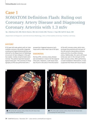 Clinical Results Cardio-Vascular 
Case 1 
SOMATOM Defi nition Flash: Ruling out 
Coronary Artery Disease and Diagnosing 
Coronary Arteritis with 1.3 mSv 
By J. Matthias Kerl, MD, Martin Beeres, MD, Boris Schell, MD, Thomas J. Vogl, MD, Ralf W. Bauer, MD 
Department of Diagnostic and Interventional Radiology, Clinic of the Goethe University, Frankfurt, Germany 
HISTORY 
A 52-year-old male patient with an inter-mediate 
coronary risk profile (cigarette 
smoking and hypercholesterolemia) was 
referred to the Department of Radiology 
on account of two collapses in the past 
two weeks. Cardiac enzyme-levels were 
normal. The patient reported transient 
typical chest pain. The coronary CT Angi-ography 
(cCTA) was performed with a 
prospective triggered sequence tech-nique 
with a mean heart rate of 65 bpm. 
DIAGNOSIS 
During cCTA, coronary artery disease 
was excluded as a reason for the atypical 
chest pain. However, a soft tissue mass 
was found in the area of the bifurcation 
1 2 
1 VRT of the left coronary artery shows the soft tissue mass 
surrounding the vessel (arrow). 
2 VRT of the right coronary artery shows the soft tissue mass 
surrounding the vessel (arrow). 
34 SOMATOM Sessions · November 2011 · www.siemens.com/healthcare-magazine 
of the left coronary artery which also 
enclosed the proximal and mid part of 
the left anterior descending coronary 
artery and the circumflex coronary 
artery. Additionally, this same soft tissue 
entity was seen in the mid part of the 
right coronary artery. After performing 
curved multiplanar reformations, it was 
suspected that these soft tissue masses 
 