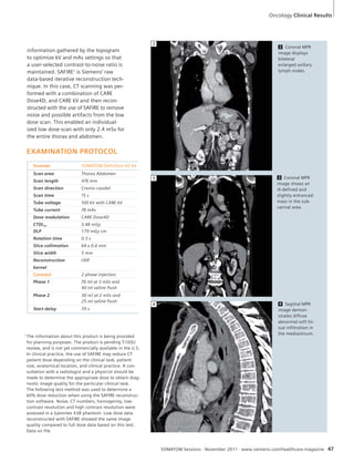 Oncology Clinical Results 
2 Coronal MPR 
image displays 
bilateral 
enlarged axillary 
lymph nodes. 
3 Coronal MPR 
image shows an 
ill-defined and 
slightly enhanced 
mass in the sub-carinal 
area. 
4 Sagittal MPR 
image demon-strates 
diffuse 
abnormal soft tis-sue 
infiltration in 
the mediastinum. 
SOMATOM Sessions · November 2011 · www.siemens.com/healthcare-magazine 47 
information gathered by the topogram 
to optimize kV and mAs settings so that 
a user-selected contrast-to-noise ratio is 
maintained. SAFIRE1 is Siemens’ raw 
data-based iterative reconstruction tech-nique. 
In this case, CT scanning was per-formed 
with a combination of CARE 
Dose4D, and CARE kV and then recon-structed 
with the use of SAFIRE to remove 
noise and possible artifacts from the low 
dose scan. This enabled an individual-ized 
low dose scan with only 2.4 mSv for 
the entire thorax and abdomen. 
EXAMINATION PROTOCOL 
Scanner SOMATOM Definition AS 64 
Scan area Thorax Abdomen 
Scan length 476 mm 
Scan direction Cranio-caudal 
Scan time 15 s 
Tube voltage 100 kV with CARE kV 
Tube current 78 mAs 
Dose modulation CARE Dose4D 
CTDIvol 3.48 mGy 
DLP 170 mGy cm 
Rotation time 0.5 s 
Slice collimation 64 x 0.6 mm 
Slice width 5 mm 
Reconstruction 
I30f 
kernel 
Contrast 2 phase injection 
Phase 1 70 ml at 3 ml/s and 
40 ml saline flush 
Phase 2 30 ml at 2 ml/s and 
25 ml saline flush 
Start delay 70 s 
2 
3 
4 
1 The information about this product is being provided 
for planning purposes. The product is pending 510(k) 
review, and is not yet commercially available in the U.S. 
In clinical practice, the use of SAFIRE may reduce CT 
patient dose depending on the clinical task, patient 
size, anatomical location, and clinical practice. A con-sultation 
with a radiologist and a physicist should be 
made to determine the appropriate dose to obtain diag-nostic 
image quality for the particular clinical task. 
The following test method was used to determine a 
60% dose reduction when using the SAFIRE reconstruc-tion 
software. Noise, CT numbers, homogenity, low-contrast 
resolution and high contrast resolution were 
assessed in a Gammex 438 phantom. Low dose data 
reconstructed with SAFIRE showed the same image 
quality compared to full dose data based on this test. 
Data on file. 
 