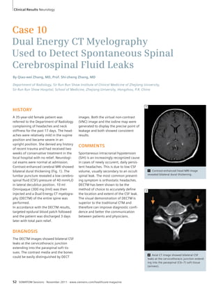 1 Contrast-enhanced head MRI image 
revealed bilateral dural thickening. 
2 Axial CT image showed bilateral CSF 
leaks at the cervicothoracic junction extend-ing 
into the paraspinal (C6–7) soft tissue 
(arrows). 
1 
2 
Clinical Results Neurology 
Case 10 
Dual Energy CT Myelography 
Used to Detect Spontaneous Spinal 
Cerebrospinal Fluid Leaks 
By Qiao-wei Zhang, MD, Prof. Shi-zheng Zhang, MD 
Department of Radiology, Sir Run Run Shaw Institute of Clinical Medicine of Zhejiang University, 
Sir Run Run Shaw Hospital, School of Medicine, Zhejiang University, Hangzhou, P.R. China 
HISTORY 
A 35-year-old female patient was 
referred to the Department of Radiology 
complaining of headaches and neck 
stiffness for the past 17 days. The head-aches 
were relatively mild in the supine 
position and became severe in an 
upright position. She denied any history 
of recent trauma and had received two 
weeks of conservative treatment in the 
local hospital with no relief. Neurologi-cal 
exams were normal at admission. 
Contrast-enhanced cerebral MRI showed 
bilateral dural thickening (Fig. 1). The 
lumbar puncture revealed a low cerebro-spinal 
fluid (CSF) pressure of 40 mmH2O 
in lateral decubitus position. 10 ml 
Omnipaque (300 mg J/ml) was then 
injected and a Dual Energy CT myelogra-phy 
(DECTM) of the entire spine was 
performed. 
In accordance with the DECTM results, 
targeted epidural blood patch followed 
and the patient was discharged 3 days 
later with total pain relief. 
DIAGNOSIS 
The DECTM images showed bilateral CSF 
leaks at the cervicothoracic junction 
extending into the paraspinal soft tis-sues. 
The contrast media and the bones 
could be easily distinguished by DECT 
images. Both the virtual non-contrast 
(VNC) image and the iodine map were 
generated to display the precise point of 
leakage and both showed consistent 
results. 
COMMENTS 
Spontaneous intracranial hypotension 
(SIH) is an increasingly recognized cause 
in cases of newly occurent, daily persis-tent 
headaches. This is due to low CSF 
volume, usually secondary to an occult 
spinal leak. The most common present-ing 
symptom is orthostatic headaches. 
DECTM has been shown to be the 
method of choice to accurately define 
the location and extent of the CSF leak. 
The visual demonstration of DECTM is 
superior to the traditional CTM and 
therefore can improve diagnostic confi-dence 
and better the communication 
between patients and physicians. 
52 SOMATOM Sessions · November 2011 · www.siemens.com/healthcare-magazine 
 