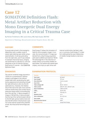 Clinical Results Acute Care 
Case 12 
SOMATOM Defi nition Flash: 
Metal Artifact Reduction with 
Mono Energetic Dual Energy 
Imaging in a Critical Trauma Case 
By Florian Fintelmann, MD, Laura Avery, MD, Rajiv Gupta, MD PhD 
Department of Radiology, Massachusetts General Hospital, Boston, MA, USA 
HISTORY 
A young male arrived in the emergency 
department with a sudden onset of 
severe right-sided eye pain while using a 
weed whacker. A nail was protruding 
from the right orbit, and CT was ordered 
to evaluate intracranial injury. Imaging 
was performed on a 64-slice CT, and sub-sequently 
on the 2x128-slice Siemens 
Dual Source CT scanner – the SOMATOM 
Definition Flash. 
DIAGNOSIS 
The volume rendered image acquired at 
120 kV on a conventional CT demon-strated 
a nail lodged in the inferior/ 
medial right orbit, penetrating the right 
lamina papyracea and extending through 
the right ethmoid air cells into the left 
sphenoid sinus. However, the relation-ship 
of the nail to the optic nerve and the 
internal carotid artery was unclear due to 
extensive streak artifact surrounding the 
tip of the nail (Fig. 1). Mono energetic CT 
image at 190 keV (Fig. 2) demonstrated 
that the tip of the nail terminated inferior 
to the left optic groove (solid arrow) and 
abut the left anterior clinoid process supe-rior 
to the internal carotid artery (dashed 
arrow). No intracranial hemorrhage was 
seen. 
COMMENTS 
Dual Energy CT allows the simulation of 
high-kV mono energetic images. In our 
case, the monochromatic CT image was 
derived from a Dual Energy acquisition 
with tube A at 80 kV and tube B at 140 kV. 
The advantage lies in the reduction of 
streak artifacts surrounding metallic for-eign 
bodies. Our patient was spared open 
surgery, once injury to optic nerve and 
internal carotid artery had been ruled 
out. In summary, Dual Energy CT is help-ful 
in delineating the exact relationship 
of metallic foreign bodies to vital struc-tures. 
EXAMINATION PROTOCOL 
Scanner SOMATOM Definition Flash 
Scan area DE Head 
Scan length 191 mm 
Scan direction Cranio-caudal 
Scan time 8 s 
Tube voltage A/B 80 kV / 140 kV 
Tube current 400 eff. mAs / 200 eff. mAs 
Dose modulation CARE Dose4D 
CTDIvol 34.65 mGy 
DLP 718 mGy cm 
Rotation time 0.5 s 
Slice collimation 32 x 0.6 mm 
Slice width 1 mm 
Reconstruction kernel D45f 
Postprocessing syngo Dual Energy 
56 SOMATOM Sessions · November 2011 · www.siemens.com/healthcare-magazine 
 
