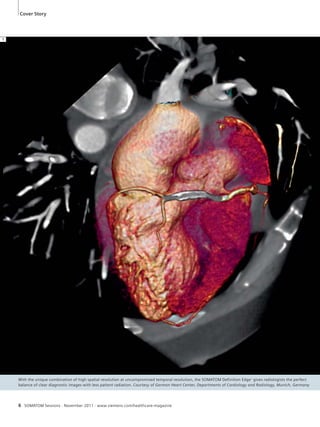 Cover Story 
With the unique combination of high spatial resolution at uncompromised temporal resolution, the SOMATOM Definition Edge1 gives radiologists the perfect 
balance of clear diagnostic images with less patient radiation. Courtesy of German Heart Center, Departments of Cardiology and Radiology, Munich, Germany 
6 SOMATOM Sessions · November 2011 · www.siemens.com/healthcare-magazine 
1 
 