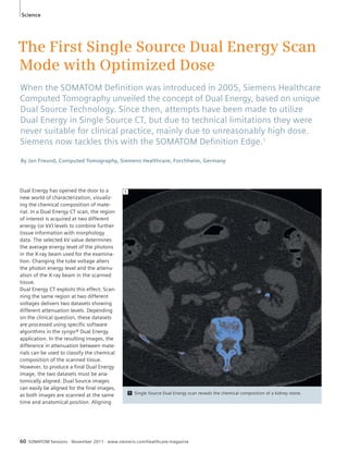 Science 
The First Single Source Dual Energy Scan 
Mode with Optimized Dose 
When the SOMATOM Defi nition was introduced in 2005, Siemens Healthcare 
Computed Tomography unveiled the concept of Dual Energy, based on unique 
Dual Source Technology. Since then, attempts have been made to utilize 
Dual Energy in Single Source CT, but due to technical limitations they were 
never suitable for clinical practice, mainly due to unreasonably high dose. 
Siemens now tackles this with the SOMATOM Defi nition Edge.1 
By Jan Freund, Computed Tomography, Siemens Healthcare, Forchheim, Germany 
Dual Energy has opened the door to a 
new world of characterization, visualiz-ing 
the chemical composition of mate-rial. 
In a Dual Energy CT scan, the region 
of interest is acquired at two different 
energy (or kV) levels to combine further 
tissue information with morphology 
data. The selected kV value determines 
the average energy level of the photons 
in the X-ray beam used for the examina-tion. 
Changing the tube voltage alters 
the photon energy level and the attenu-ation 
of the X-ray beam in the scanned 
tissue. 
Dual Energy CT exploits this effect: Scan-ning 
the same region at two different 
voltages delivers two datasets showing 
different attenuation levels. Depending 
on the clinical question, these datasets 
are processed using specific software 
algorithms in the syngo® Dual Energy 
application. In the resulting images, the 
difference in attenuation between mate-rials 
can be used to classify the chemical 
composition of the scanned tissue. 
However, to produce a final Dual Energy 
image, the two datasets must be ana-tomically 
aligned. Dual Source images 
can easily be aligned for the final images, 
as both images are scanned at the same 
time and anatomical position. Aligning 
1 Single Source Dual Energy scan reveals the chemical composition of a kidney stone. 
1 
60 SOMATOM Sessions · November 2011 · www.siemens.com/healthcare-magazine 
 