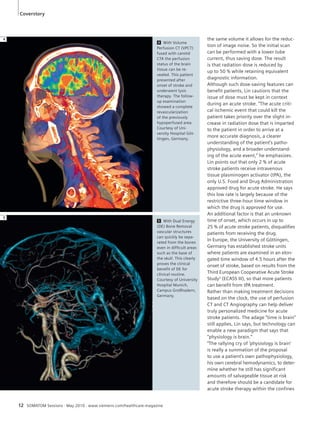 Coverstory 
4 With Volume 
Perfusion CT (VPCT) 
fused with carotid 
CTA the perfusion 
status of the brain 
tissue can be re-vealed. 
12 SOMATOM Sessions · May 2010 · www.siemens.com/healthcare-magazine 
This patient 
presented after 
onset of stroke and 
underwent lysis 
therapy. The follow-up 
examination 
showed a complete 
revascularization 
of the previously 
hypoperfused area. 
Courtesy of Uni-versity 
Hospital Göt-tingen, 
Germany. 
the same volume it allows for the reduc-tion 
of image noise. So the initial scan 
can be performed with a lower tube 
current, thus saving dose. The result 
is that radiation dose is reduced by 
up to 50 % while retaining equivalent 
diagnostic information. 
Although such dose-saving features can 
benefit patients, Lin cautions that the 
issue of dose must be kept in context 
during an acute stroke. “The acute criti-cal 
ischemic event that could kill the 
patient takes priority over the slight in-crease 
in radiation dose that is imparted 
to the patient in order to arrive at a 
more accurate diagnosis, a clearer 
understanding of the patient’s patho-physiology, 
and a broader understand-ing 
of the acute event,” he emphasizes. 
Lin points out that only 2 % of acute 
stroke patients receive intravenous 
tissue plasminogen activator (tPA), the 
only U.S. Food and Drug Administration 
approved drug for acute stroke. He says 
this low rate is largely because of the 
restrictive three-hour time window in 
which the drug is approved for use. 
An additional factor is that an unknown 
time of onset, which occurs in up to 
25 % of acute stroke patients, disqualifies 
patients from receiving the drug. 
In Europe, the University of Göttingen, 
Germany has established stroke units 
where patients are examined in an elon-gated 
time window of 4.5 hours after the 
onset of stroke, based on results from the 
Third European Cooperative Acute Stroke 
Study3 (ECASS III), so that more patients 
can benefit from tPA treatment. 
Rather than making treatment decisions 
based on the clock, the use of perfusion 
CT and CT Angiography can help deliver 
truly personalized medicine for acute 
stroke patients. The adage “time is brain” 
still applies, Lin says, but technology can 
enable a new paradigm that says that 
“physiology is brain.” 
“The rallying cry of ‘physiology is brain’ 
is really a summation of the proposal 
to use a patient’s own pathophysiology, 
his own cerebral hemodynamics, to deter-mine 
whether he still has significant 
amounts of salvageable tissue at risk 
and therefore should be a candidate for 
acute stroke therapy within the confines 
5 With Dual Energy 
(DE) Bone Removal 
vascular structures 
can quickly be sepa-rated 
from the bones 
even in difficult areas 
such as the base of 
the skull. This clearly 
proves the clinical 
benefit of DE for 
clinical routine. 
Courtesy of University 
Hospital Munich, 
Campus Großhadern, 
Germany. 
4 
5 
 