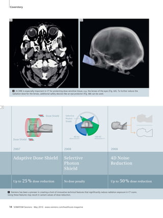 Coverstory 
6A 6B 
6 X-CARE is especially important in CT for protecting dose sensitive tissue, e.g. the lenses of the eyes (Fig. 6A). To further reduce the 
radiation dose for the lenses, additional safety devices like an eye protector (Fig. 6B) can be used. 
2008 
4D N oise 
Reduction 
Up to 50 % dose reduction 
2007 
Adaptive Dose Shield 
Up to 25 % dose reduction 
Selective 
Photon 
Shield 
2008 
Selective 
Photon 
Shield 
No dose penalty 
140 kV 
Attenuation A 
80 kV 
Attenuation B 
Dose Shield 
Dose Shield 
7 Siemens has been a pioneer in creating a host of innovative technical features that significantly reduce radiation exposure in CT scans. 
Using these features may result in variant values of dose reduction. 
14 SOMATOM Sessions · May 2010 · www.siemens.com/healthcare-magazine 
7 
 