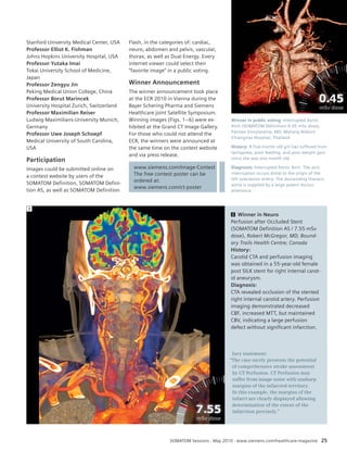Winner in public voting: Interrupted Aortic 
Arch (SOMATOM Definition/ 0.45 mSv dose), 
Pannee Visrutaratna, MD, Maharaj Nokorn 
Chiangmai Hospital, Thailand 
History: A five-month old girl has suffered from 
tachypnea, poor feeding, and poor weight gain 
since she was one month old. 
Diagnosis: Interrupted Aortic Arch. The arch 
interruption occurs distal to the origin of the 
left subclavian artery. The descending thoracic 
aorta is supplied by a large patent ductus 
arteriosus. 
SOMATOM Sessions · May 2010 · www.siemens.com/healthcare-magazine 25 
Stanford University Medical Center, USA 
Professor Elliot K. Fishman 
Johns Hopkins University Hospital, USA 
Professor Yutaka Imai 
Tokai University School of Medicine, 
Japan 
Professor Zengyu Jin 
Peking Medical Union College, China 
Professor Borut Marincek 
University Hospital Zurich, Switzerland 
Professor Maximilian Reiser 
Ludwig-Maximilians-University Munich, 
Germany 
Professor Uwe Joseph Schoepf 
Medical University of South Carolina, 
USA 
Participation 
Images could be submitted online on 
a contest website by users of the 
SOMATOM Definition, SOMATOM Defini-tion 
AS, as well as SOMATOM Definition 
<<b<i<ttbei tüteb eürbaellr malli tm Diot sDiso-sTiasc-Thaoc>h>o>> 
2 Winner in Neuro 
Perfusion after Occluded Stent 
(SOMATOM Definition AS / 7.55 mSv 
dose), Robert McGregor, MD; Bound-ary 
Trails Health Centre; Canada 
History: 
Carotid CTA and perfusion imaging 
was obtained in a 55-year-old female 
post SILK stent for right internal carot-id 
aneurysm. 
Diagnosis: 
CTA revealed occlusion of the stented 
right internal carotid artery. Perfusion 
imaging demonstrated decreased 
CBF, increased MTT, but maintained 
CBV, indicating a large perfusion 
defect without significant infarction. 
Flash, in the categories of: cardiac, 
neuro, abdomen and pelvis, vascular, 
thorax, as well as Dual Energy. Every 
internet viewer could select their 
“favorite image” in a public voting. 
Winner Announcement 
The winner announcement took place 
at the ECR 2010 in Vienna during the 
Bayer Schering Pharma and Siemens 
Healthcare joint Satellite Symposium. 
Winning images (Figs. 1–6) were ex-hibited 
at the Grand CT Image Gallery. 
For those who could not attend the 
ECR, the winners were announced at 
the same time on the contest website 
and via press release. 
Jury statement: 
“The case nicely presents the potential 
of comprehensive stroke assessment 
by CT Perfusion. CT Perfusion may 
suffer from image noise with unsharp 
margins of the infarcted territory. 
In this example, the margins of the 
infarct are clearly displayed allowing 
determination of the extent of the 
infarction precisely.” 
2 
www.siemens.com/Image-Contest 
The free contest poster can be 
ordered at: 
www.siemens.com/ct-poster 
 