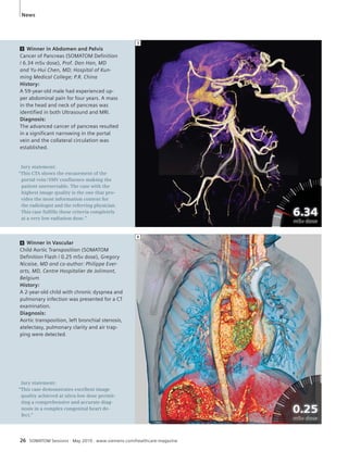 News 
3 Winner in Abdomen and Pelvis 
Cancer of Pancreas (SOMATOM Definition 
/ 6.34 mSv dose), Prof. Dan Han, MD 
and Yu-Hui Chen, MD; Hospital of Kun-ming 
Medical College; P.R. China 
History: 
A 59-year-old male had experienced up-per 
abdominal pain for four years. A mass 
in the head and neck of pancreas was 
identified in both Ultrasound and MRI. 
Diagnosis: 
The advanced cancer of pancreas resulted 
in a significant narrowing in the portal 
vein and the collateral circulation was 
established. 
Jury statement: 
“This CTA shows the encasement of the 
portal vein / SMV confl uence making the 
patient unresectable. The case with the 
highest image quality is the one that pro-vides 
the most information content for 
the radiologist and the referring physician. 
This case fulfi lls these criteria completely 
at a very low radiation dose.” 
4 Winner in Vascular 
Child Aortic Transposition (SOMATOM 
Definition Flash / 0.25 mSv dose), Gregory 
Nicaise, MD and co-author: Philippe Ever-arts, 
MD, Centre Hospitalier de Jolimont, 
Belgium 
History: 
A 2-year-old child with chronic dyspnea and 
pulmonary infection was presented for a CT 
examination. 
Diagnosis: 
Aortic transposition, left bronchial stenosis, 
atelectasy, pulmonary clarity and air trap-ping 
were detected. 
Jury statement: 
“This case demonstrates excellent image 
quality achieved at ultra-low dose permit-ting 
a comprehensive and accurate diag-nosis 
in a complex congenital heart de-fect.” 
3 
4 
26 SOMATOM Sessions · May 2010 · www.siemens.com/healthcare-magazine 
 