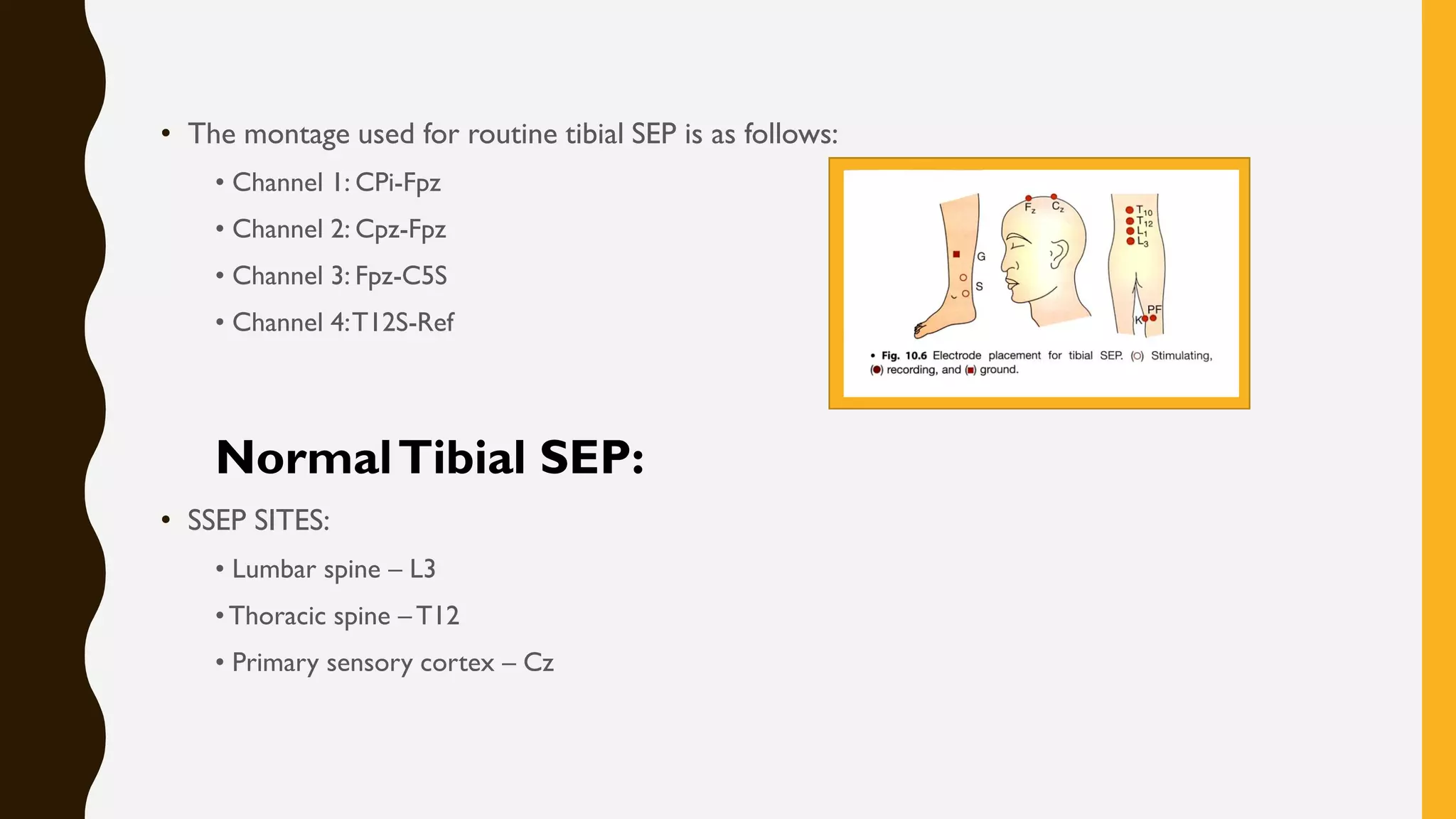 Somatosensory and motor evoked potentials by neelothpala | PDF