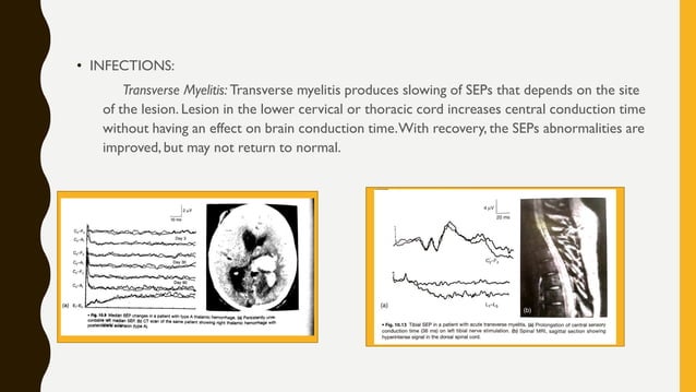 Somatosensory and motor evoked potentials by neelothpala | PDF | Death ...
