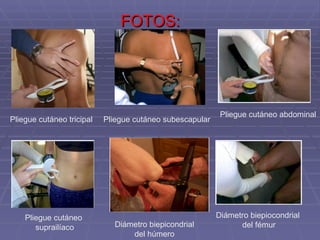 FOTOS: Pliegue cutáneo tricipal Pliegue cutáneo subescapular Diámetro biepicondrial  del húmero  Diámetro biepiocondrial  del fémur Pliegue cutáneo abdominal Pliegue cutáneo  suprailíaco 