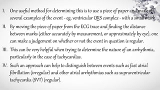 I. One useful method for determining this is to use a piece of paper and mark off
several examples of the event - eg, ventricular QRS complex - with a small mark.
II. By moving the piece of paper from the ECG trace and finding the distance
between marks (either accurately by measurement, or approximately by eye), one
can make a judgement on whether or not the event in question is regular.
III. This can be very helpful when trying to determine the nature of an arrhythmia,
particularly in the case of tachycardias.
IV. Such an approach can help to distinguish between events such as fast atrial
fibrillation (irregular) and other atrial arrhythmias such as supraventricular
tachycardia (SVT) (regular).
 