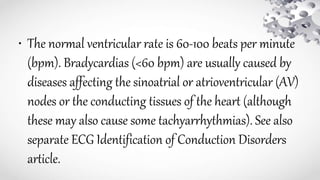 • The normal ventricular rate is 60-100 beats per minute
(bpm). Bradycardias (<60 bpm) are usually caused by
diseases affecting the sinoatrial or atrioventricular (AV)
nodes or the conducting tissues of the heart (although
these may also cause some tachyarrhythmias). See also
separate ECG Identification of Conduction Disorders
article.
 