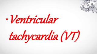 •Ventricular
tachycardia (VT)
 