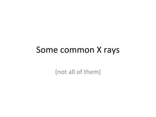 Some common X rays

    (not all of them)
 