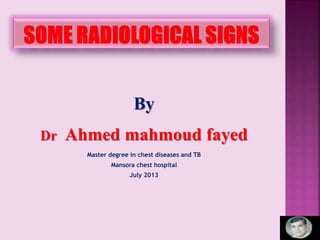 By
Dr Ahmed mahmoud fayed
Master degree in chest diseases and TB
Mansora chest hospital
July 2013
 