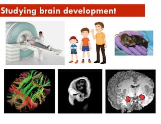 Studying brain development
 
