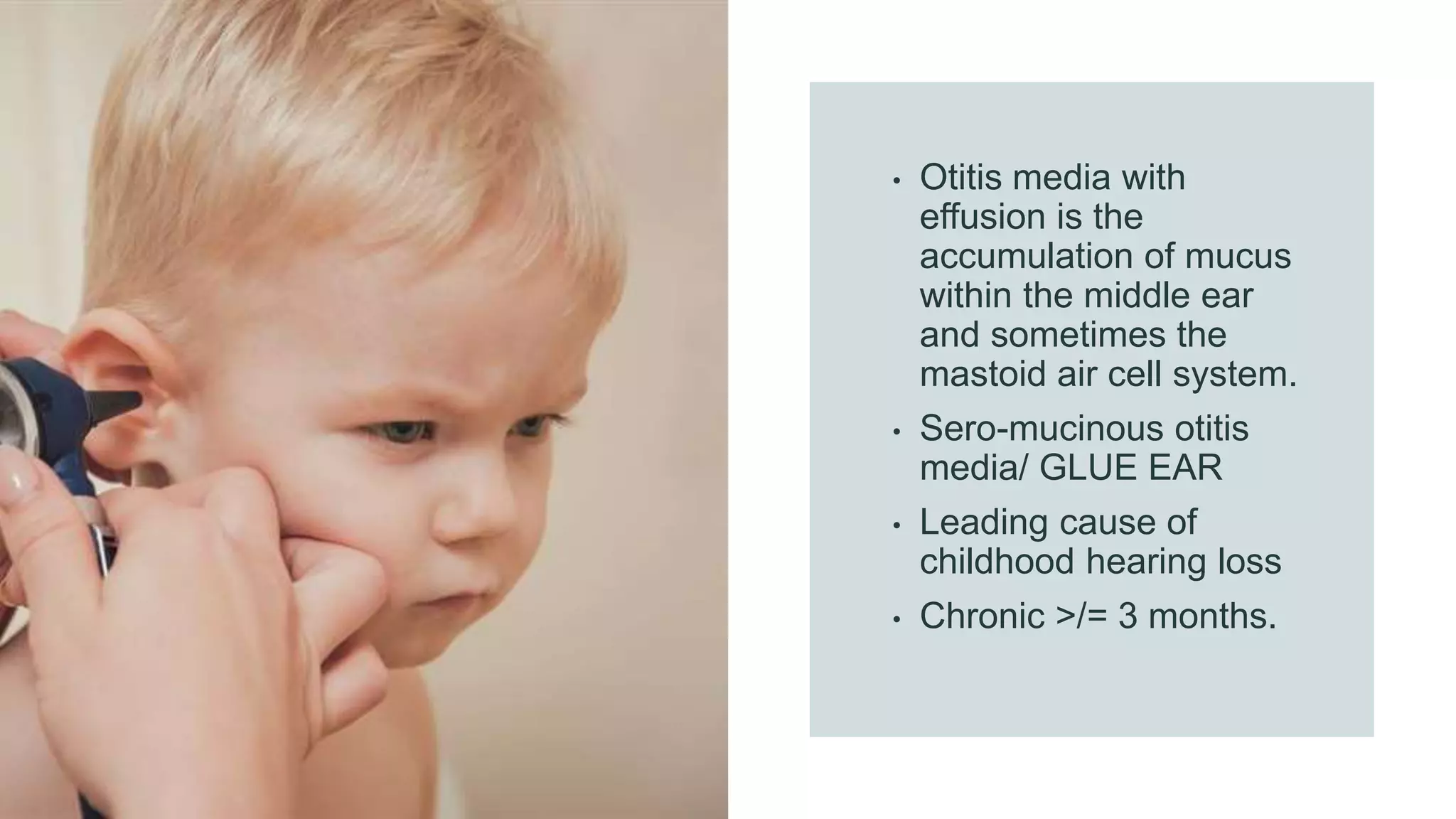 Serous Otitis media and Grommets PPT