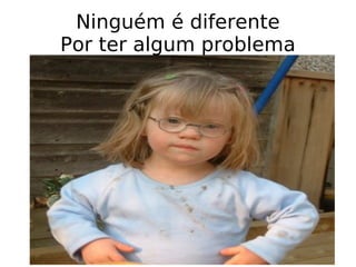 Ninguém é diferente Por ter algum problema 