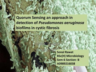 SONAL RAWAT
A0989216038Sonal Rawat
BSc(H) Microbiology
Sem-6 Section- B
A0989216038
Quorum Sensing an approach in
detection of Pseudomonas aeruginosa
biofilms in cystic fibrosis
 