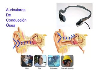 Auriculares De Conducción Ósea 