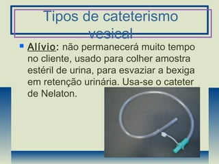 Tipos de cateterismo
vesical
 Alívio: não permanecerá muito tempo
no cliente, usado para colher amostra
estéril de urina, para esvaziar a bexiga
em retenção urinária. Usa-se o cateter
de Nelaton.
 
