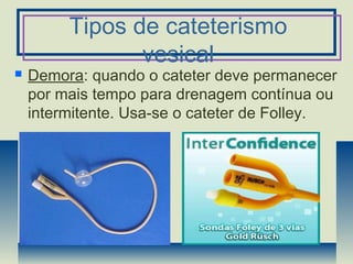 Tipos de cateterismo
vesical
 Demora: quando o cateter deve permanecer
por mais tempo para drenagem contínua ou
intermitente. Usa-se o cateter de Folley.
 