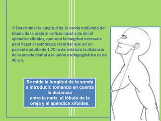 Determinar la longitud de la sonda midiendo del
lóbulo de la oreja al orificio nasal y de ahí al
apéndice xifoides, que será la longitud necesaria
para llegar al estómago; recordar que en un
paciente adulto de 1.70 m de estatura la distancia
de la arcada dental a la unión esofagogástrica es de
40 cm.



       Se mide la longitud de la sonda
       a introducir, tomando en cuenta
                  la distancia
         entre la nariz, el lóbulo de la
         oreja y el apéndice xifoides.
 