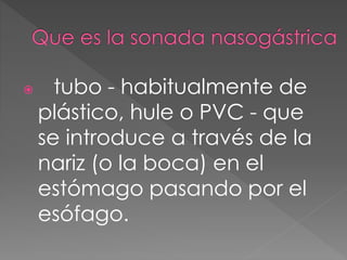  tubo - habitualmente de 
plástico, hule o PVC - que 
se introduce a través de la 
nariz (o la boca) en el 
estómago pasando por el 
esófago. 
 