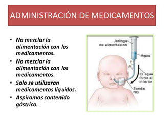 ADMINISTRACIÓN DE MEDICAMENTOS
• No mezclar la
alimentación con los
medicamentos.
• No mezclar la
alimentación con los
medicamentos.
• Solo se utilizaran
medicamentos líquidos.
• Aspiramos contenido
gástrico.
 