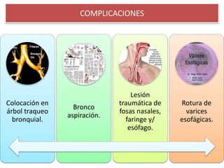 Colocación en
árbol traqueo
bronquial.
Bronco
aspiración.
Lesión
traumática de
fosas nasales,
faringe y/
esófago.
Rotura de
varices
esofágicas.
COMPLICACIONES
 