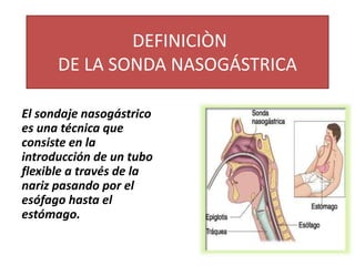 DEFINICIÒN
DE LA SONDA NASOGÁSTRICA
El sondaje nasogástrico
es una técnica que
consiste en la
introducción de un tubo
flexible a través de la
nariz pasando por el
esófago hasta el
estómago.
 