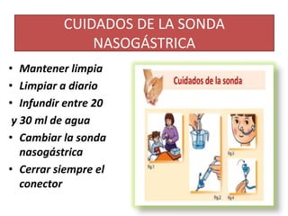 CUIDADOS DE LA SONDA
NASOGÁSTRICA
• Mantener limpia
• Limpiar a diario
• Infundir entre 20
y 30 ml de agua
• Cambiar la sonda
nasogástrica
• Cerrar siempre el
conector
 
