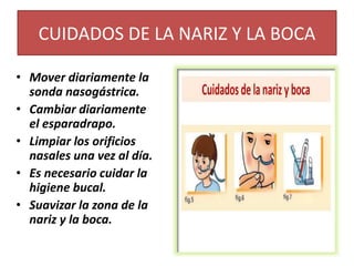 CUIDADOS DE LA NARIZ Y LA BOCA
• Mover diariamente la
sonda nasogástrica.
• Cambiar diariamente
el esparadrapo.
• Limpiar los orificios
nasales una vez al día.
• Es necesario cuidar la
higiene bucal.
• Suavizar la zona de la
nariz y la boca.
 