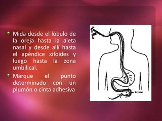 Mida desde el lóbulo de 
la oreja hasta la aleta 
nasal y desde allí hasta 
el apéndice xifoides y 
luego hasta la zona 
umbilical. 
Marque el punto 
determinado con un 
plumón o cinta adhesiva 
 