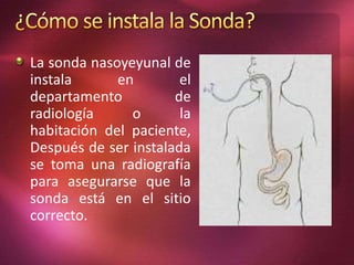 La sonda nasoyeyunal de 
instala en el 
departamento de 
radiología o la 
habitación del paciente, 
Después de ser instalada 
se toma una radiografía 
para asegurarse que la 
sonda está en el sitio 
correcto. 
 