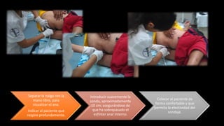 Separar la nalga con la
mano libre, para
visualizar el ano.
Indicar al paciente que
respire profundamente.
Introducir suavemente la
sonda, aproximadamente
10 cm; asegurándose de
que ha sobrepasado el
esfínter anal interno.
Colocar al paciente de
forma confortable y que
permita la efectividad del
sondaje.
 