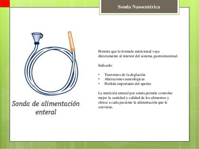TIPOS DE SONDAS VESICLES DOWNLOAD TIPOS DE SONDAS VESICLES DOWNLOAD