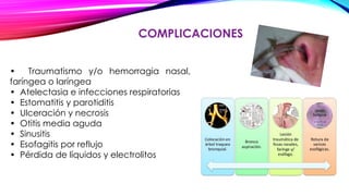 COMPLICACIONES
• Traumatismo y/o hemorragia nasal,
faríngea o laríngea
• Atelectasia e infecciones respiratorias
• Estomatitis y parotiditis
• Ulceración y necrosis
• Otitis media aguda
• Sinusitis
• Esofagitis por reflujo
• Pérdida de líquidos y electrolitos
 