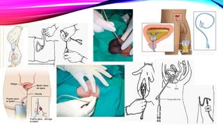 SONDAS ...................................