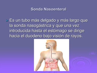 Sonda Nasoenteral
 Es

un tubo más delgado y más largo que
la sonda nasogástrica y que una vez
introducida hasta el estómago se dirige
hacia el duodeno bajo visión de rayos.

 
