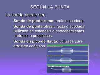 SEGÚN LA PUNTA
La sonda puede ser:
-

-

Sonda de punta roma: recta o acodada.
Sonda de punta olivar: recta o acodada.
Utilizada en estenosis o estrechamientos
uretrales o prostáticos.
Sonda en pico de flauta: utilizada para
arrastrar coágulos.

 