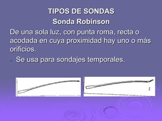 TIPOS DE SONDAS
Sonda Robinson
De una sola luz, con punta roma, recta o
acodada en cuya proximidad hay uno o más
orificios.
- Se usa para sondajes temporales.

 