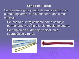 Sonda de Pezzer
Sonda semirrígida y recta de una sola luz, con
punta fungiforme, que puede tener dos o más
orificios.
- Se inserta quirúrgicamente como sondaje
permanente y se fija a la piel mediante sutura.
- Se emplea en el drenaje vesical, en el
suprapúbico y renal.

 