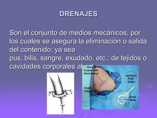 DRENAJES
Son el conjunto de medios mecánicos, por
los cuales se asegura la eliminación o salida
del contenido; ya sea
pus, bilis, sangre, exudado, etc.; de tejidos o
cavidades corporales al exterior.

 