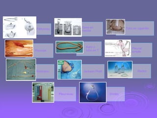 Gasa en
mecha

Filiformes

Tubo en cigarrillo

Kehr o
tubo en T

Penrose

Robinson

Pleural
simple

Redon

Jackson Pratt

Pleur-evac

Shirley

 