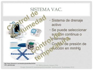 SISTEMA VAC.
• Sistema de drenaje
activo
• Se puede seleccionar
succión continua o
intermitente
• Control de presión de
succión en mmHg
http://www.infomecum.com/assets/uploads/files/04304-
VAC_aparatos.jpg Dr. Marco Antonio Cedano Ortiz
Cirugía General & Laparoscopia/Universidad Autónoma de Guadalajara 2016
 